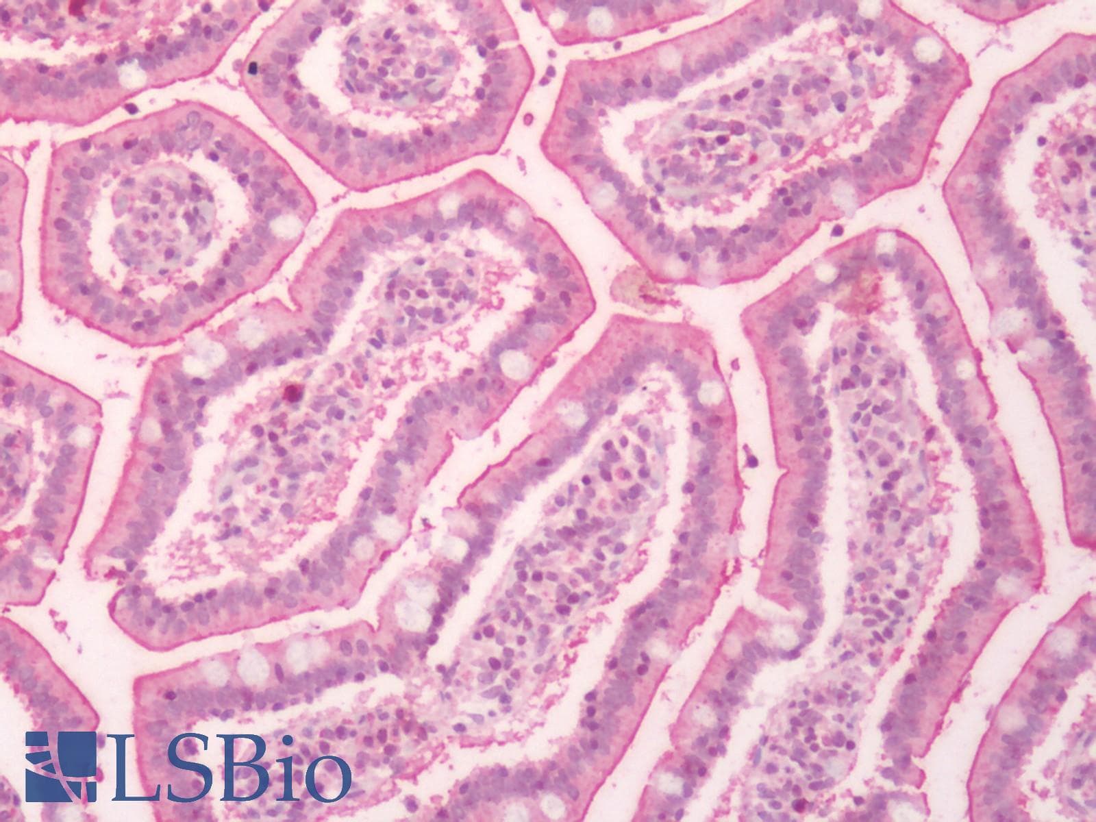 PathPlus™ Polyclonal Rabbit anti-Human F2RL1 / PAR2 Antibody (C-Terminus, IHC)