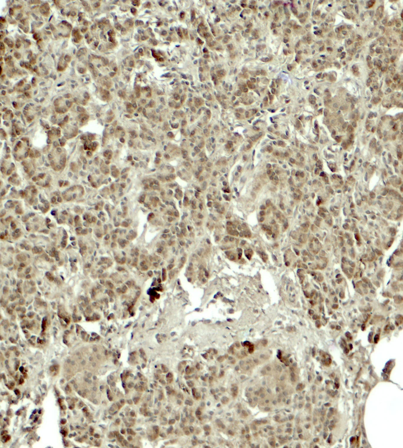 KIRREL2 / FILTRIN Antibody