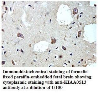 Polyclonal Rabbit anti-Human KIAA0513 Antibody (aa110-298, IHC, WB)