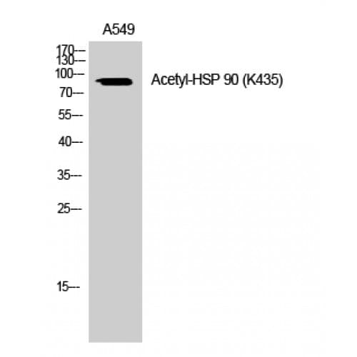 Polyclonal Rabbit anti-Human HSP90 / Heat Shock Protein 90 Antibody (acetylation site of K435., WB)