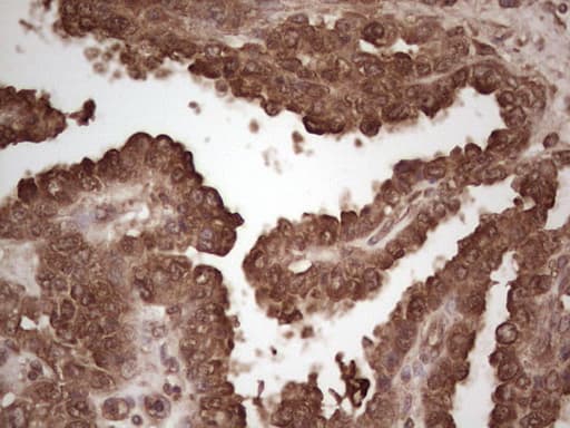 MSLN / Mesothelin Antibody (aa270-493, clone OTI4H6)