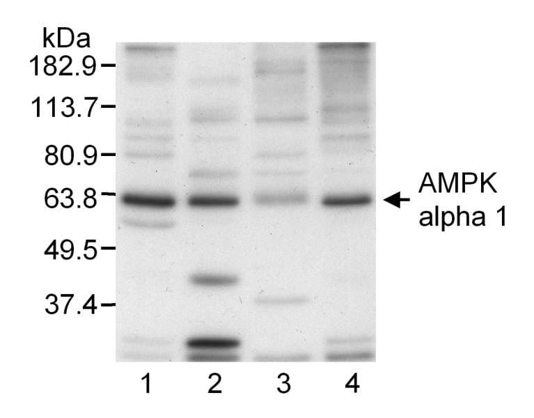 IHC-plus™ Polyclonal Rabbit anti-Human PRKAA1 / AMPK Alpha 1 Antibody (aa350-400, IHC, WB)