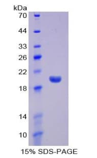 Mouse IFNA13 Protein (Recombinant His)