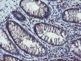 COMMD1 Antibody (clone OTI1F2)