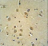 ZIC3 Antibody (aa239-267)