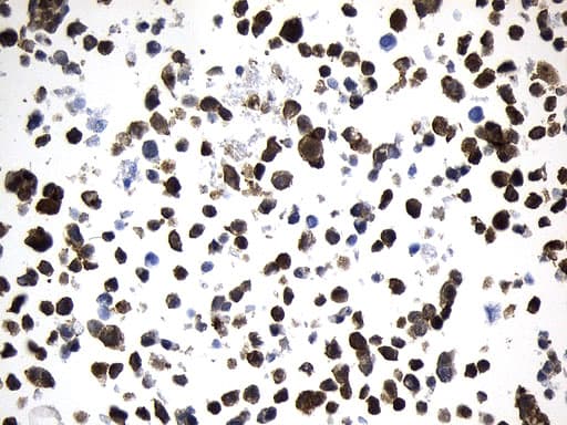 VIL1 / Villin Antibody (aa1-188, clone UMAB230)