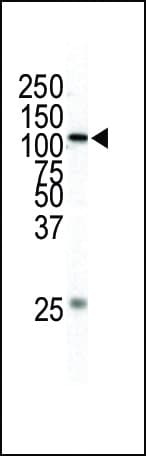 MAP3K1 / MEKK1 Antibody (aa1145-1176)