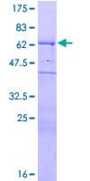 Human WIPF1 / WIP Protein (Recombinant GST)