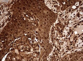 Monoclonal Mouse anti-Human GAPDH Antibody (clone OTI2F8, IHC, WB)