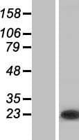TC21 / RRAS2 Protein (Over-Expression Lysate Myc-DDK (Flag))