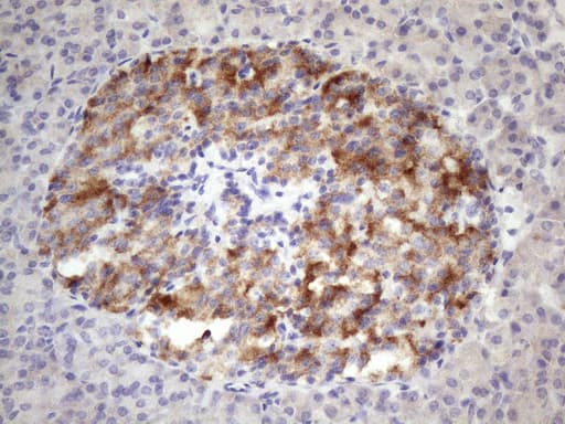 ALOX12 / 12 Lipoxygenase Antibody (clone OTI1C3)