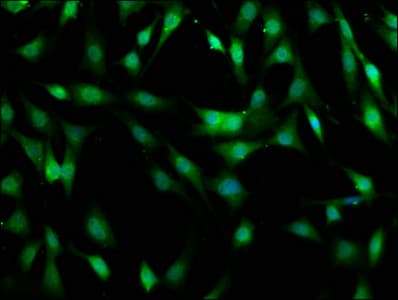 Polyclonal Rabbit anti-Human MOB1B / MOBKL1A Antibody (aa2-216, WB)