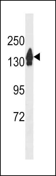 Polyclonal Rabbit anti-Human RECQL4 Antibody (aa1134-1162, WB)