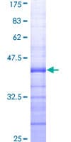 Human EZH2 Protein (Recombinant GST, N-terminus)