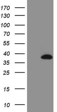 IGFBP1 Antibody (aa26-259, clone OTI4E12)