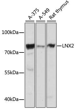 Polyclonal Rabbit anti-Human LNX2 Antibody (WB)