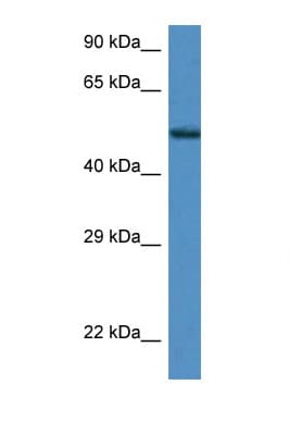 Polyclonal Rabbit anti-Mouse ZNF275 Antibody (aa350-399, WB)
