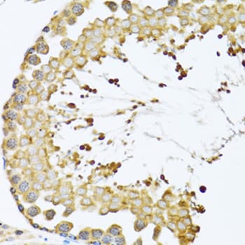 CCT4 / SRB Antibody