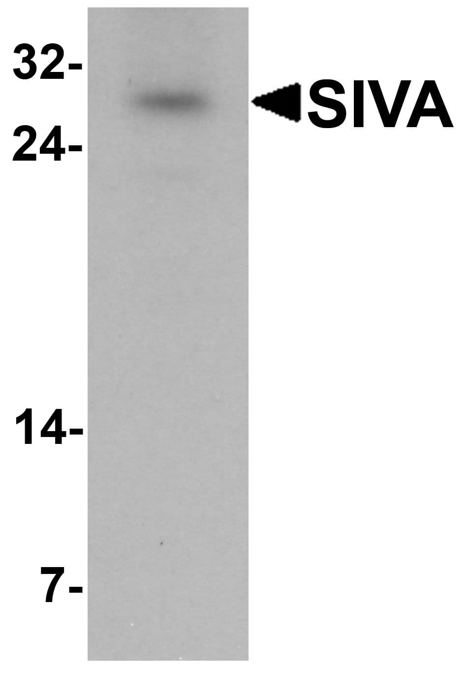 SIVA1 / SIVA Antibody