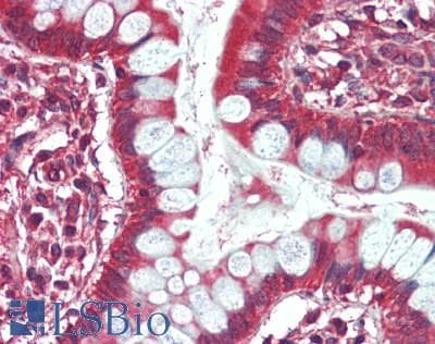 IHC-plus™ PARP4 / VPARP Antibody