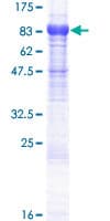 Human KIAA1467 Protein (Recombinant GST)