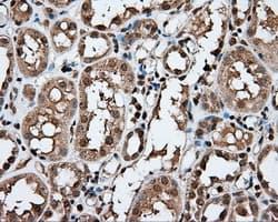APP / Beta Amyloid Precursor Antibody (clone OTI2B10)