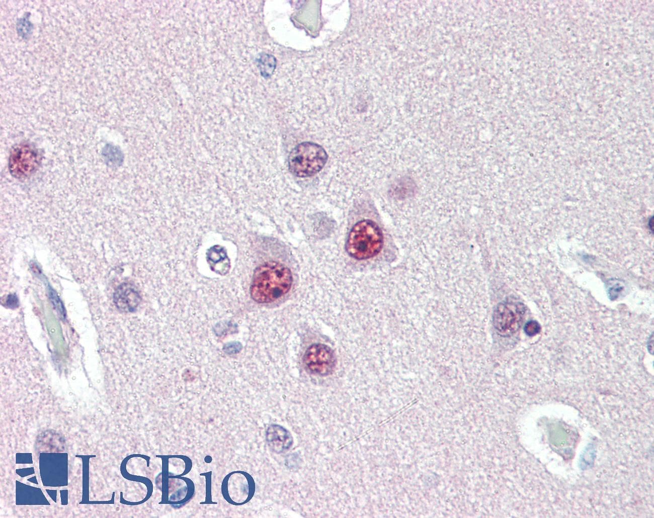 IHC-plus™ Monoclonal Mouse anti-Human UBQLN1 / Ubiquilin Antibody (clone 3D5E2, Internal, IHC, WB)