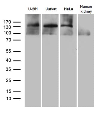 SUPT16H / FACTP140 Antibody (aa187-282, clone OTI8A1)