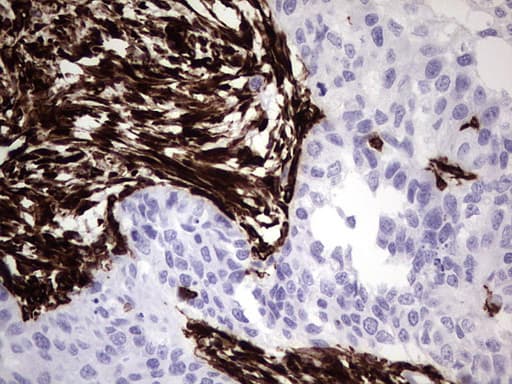 Monoclonal Mouse anti-Human Vimentin Antibody (clone UMAB160, IHC, IF, WB)