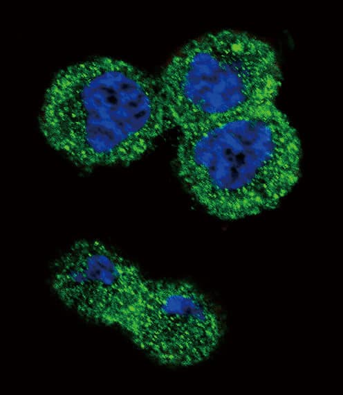 AKT1 Antibody (aa49-76)