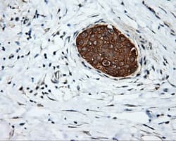 SRR / Serine Racemase Antibody (clone OTI2E3)