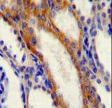 GOK / STIM1 Antibody (aa509-538)