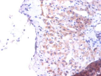 PTDSS1 Antibody