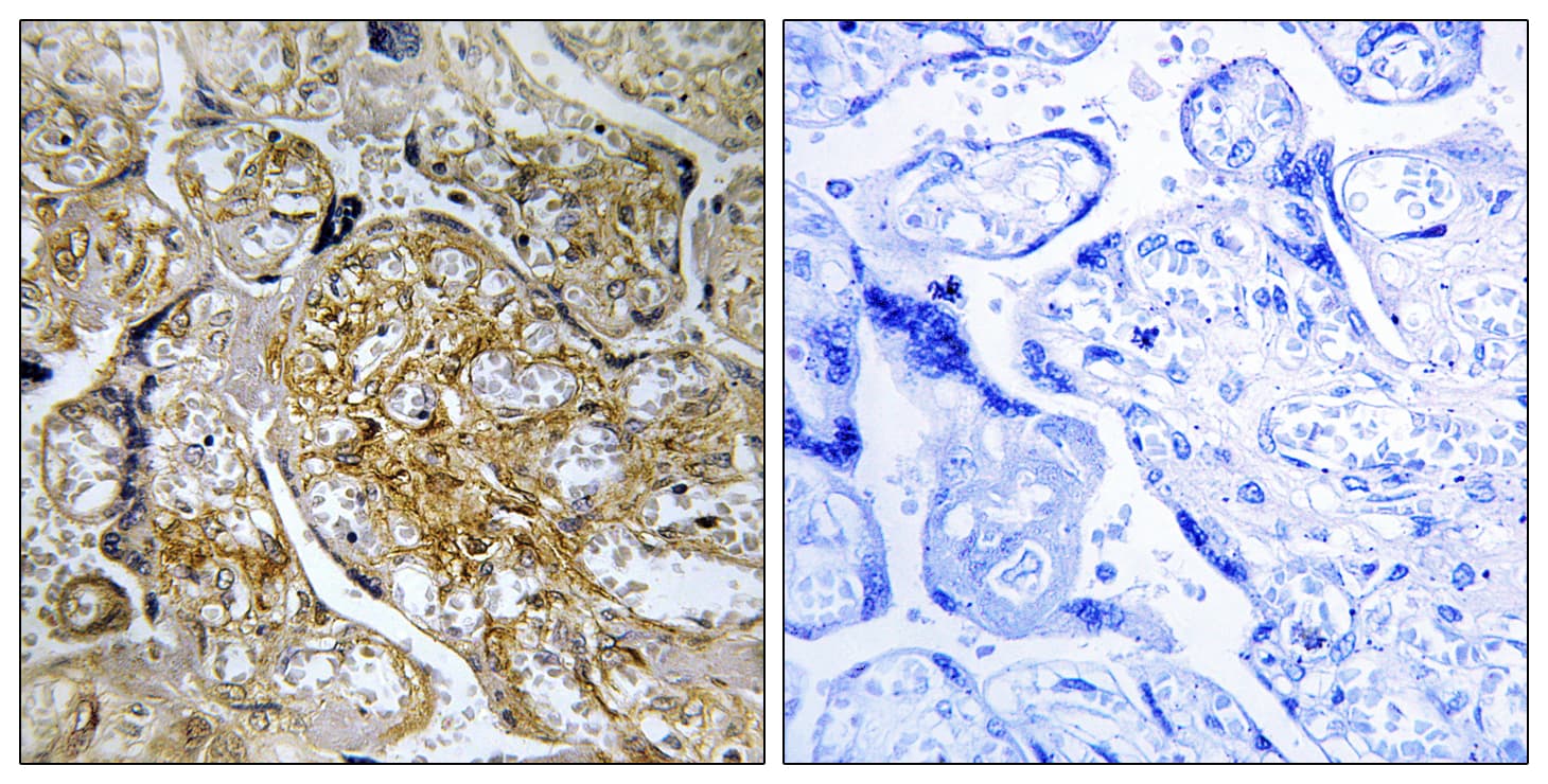 Polyclonal Rabbit anti-Human PAK1 Antibody (phospho-Ser199, IHC, WB)