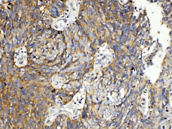 TNFRSF11A / RANK Antibody