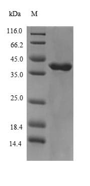 Human CHRM3 / M3 Protein (Recombinant 6His-B2M, N-terminus)