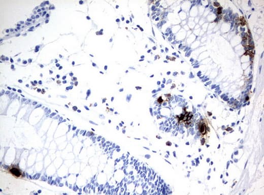 CHGA / Chromogranin A Antibody (clone UMAB109, Carrier-free)