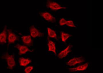 SH3BGR Antibody