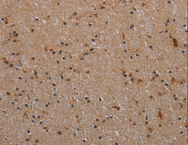 RPS6KB2 / S6K2 Antibody
