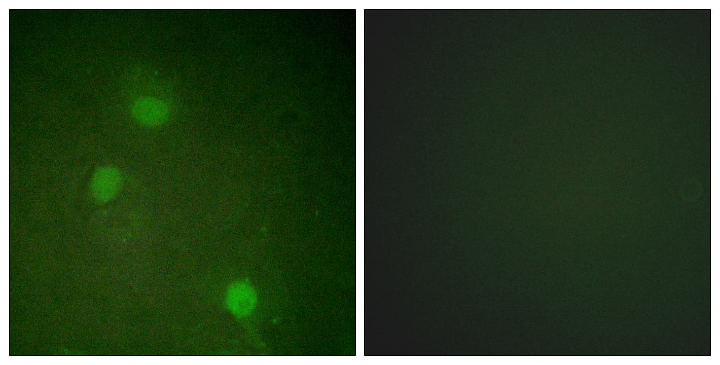 IHC-plus™ Polyclonal Rabbit anti-Human AURKB / Aurora-B Antibody (aa198-247, IHC, IF, WB)