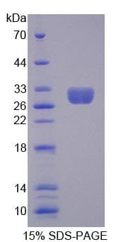 Human MECP2 Protein (Recombinant)