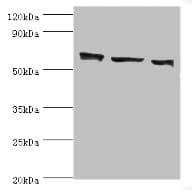 Polyclonal Rabbit anti-Human COIL / Coilin Antibody (aa297-576, IHC, WB)