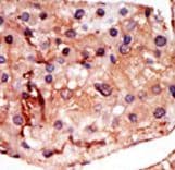 Polyclonal Rabbit anti-Human PFKFB2 Antibody (aa1-30, IHC, WB)