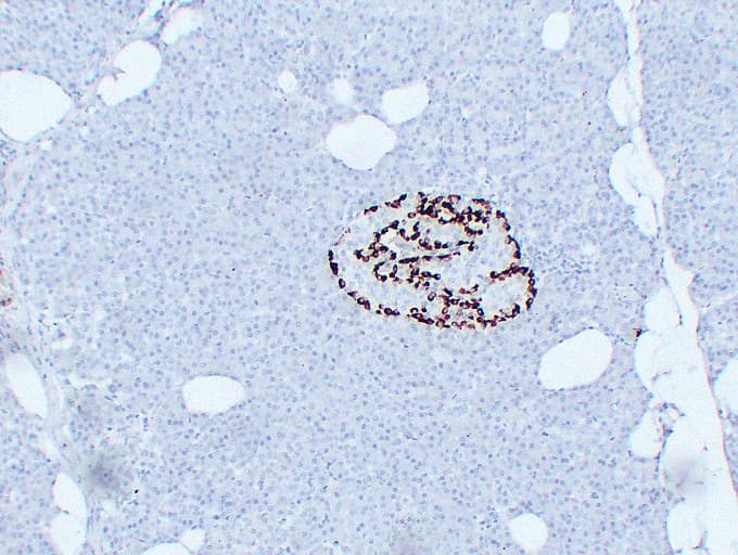 GCG / Glucagon Antibody (clone ABT-GCG)