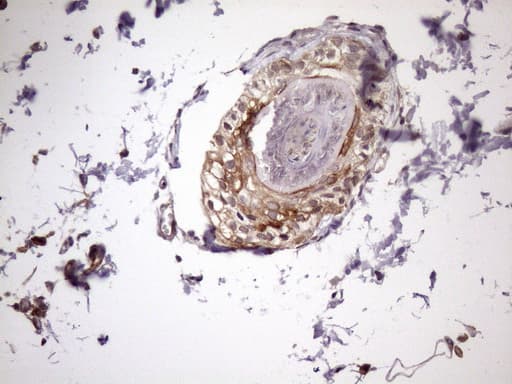 KRT16 / CK16 / Cytokeratin 16 Antibody (clone OTI6A11)