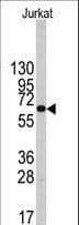 Polyclonal Rabbit anti-Human PFKFB1 Antibody (aa259-289, IHC, WB)