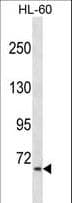 AKAP8L Antibody (aa485-512)
