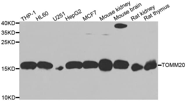 IHC-plus™ Polyclonal Rabbit anti-Human TOMM20 Antibody (IHC, IF, WB)