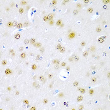 Polyclonal Rabbit anti-Human TUSC2 / FUS1 Antibody (IHC, IF, WB)