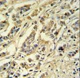 Polyclonal Rabbit anti-Human SMPDL3A Antibody (aa321-349, IHC, WB)